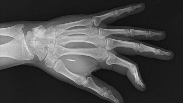 Microchip in hand